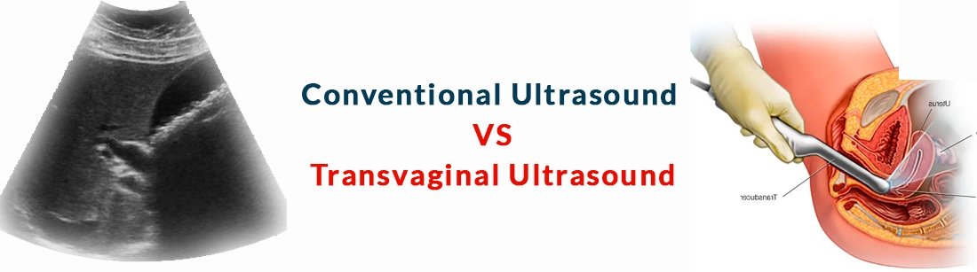 Conventional Ultrasound and Transvaginal Ultrasound